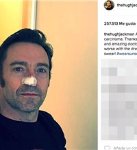 Hugh Jackman, de nuevo, se enfrenta al cáncer de piel