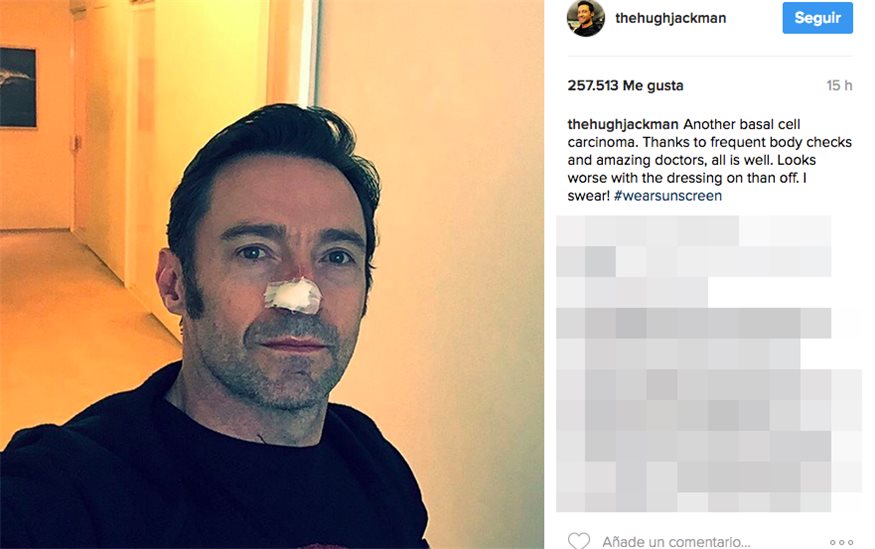 Hugh Jackman, de nuevo se enfrenta al cáncer de piel