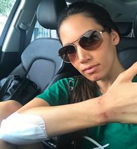 India Martínez, herida en un atraco