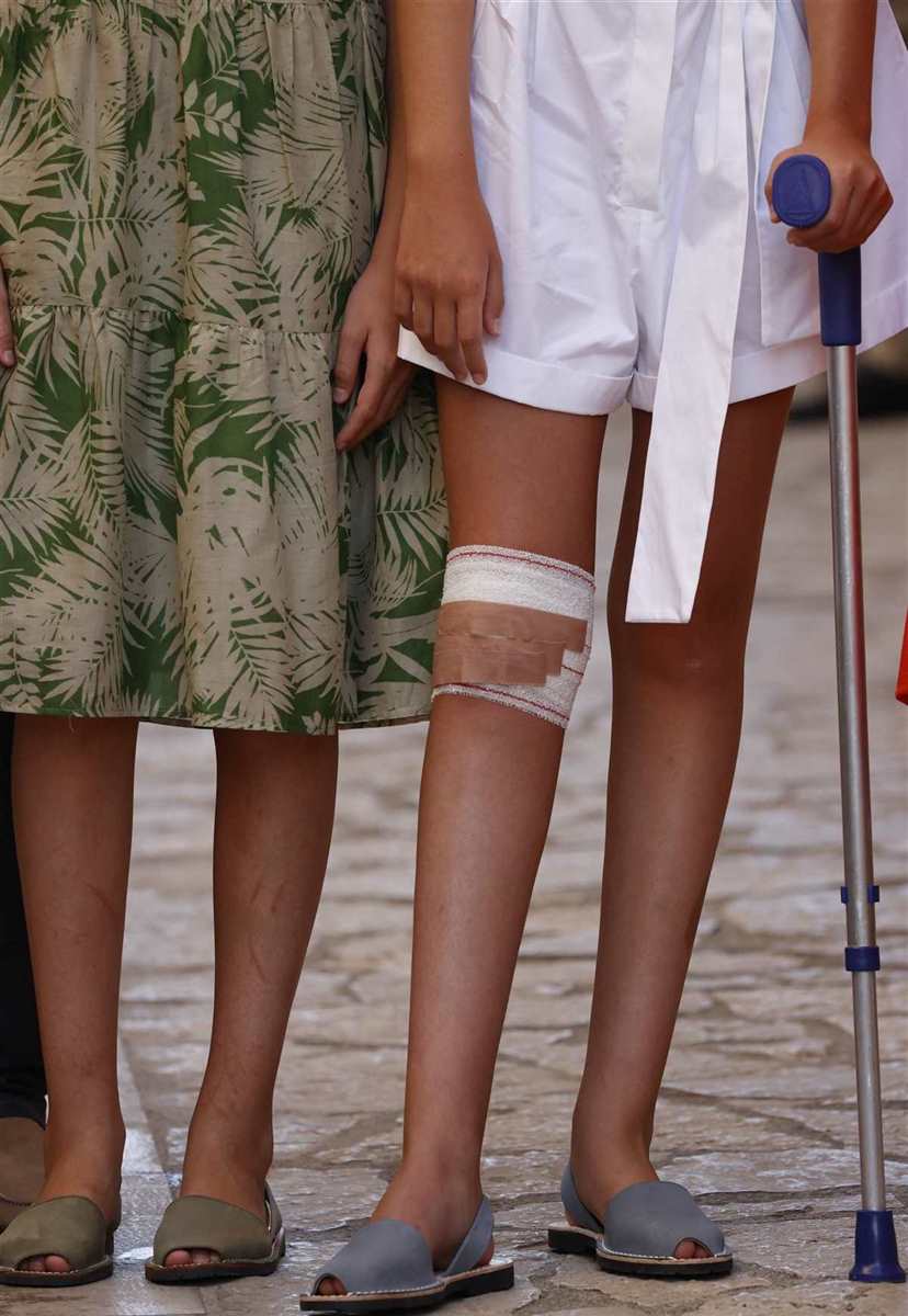 Detalle de la pierna lesionada de Sofía