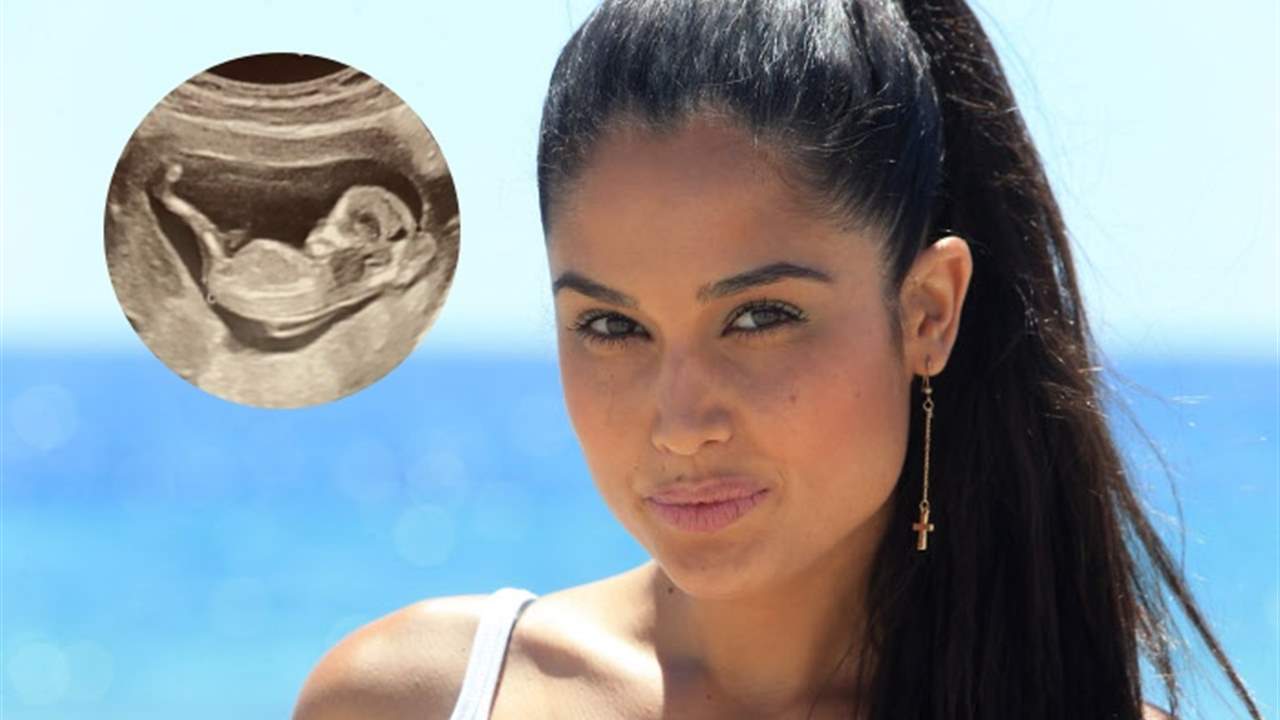 Patricia Yurena anuncia embarazo: 
